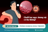 Chuỗi hạt ngọc dương vật có lây không? Những điều phái nam cần lưu ý