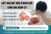 Loét bao quy đầu: Nguyên nhân, triệu chứng và cách điều trị