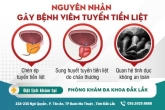 Viêm tuyến tiền liệt - Nguyên nhân, dấu hiệu và cách điều trị hiệu quả