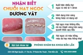 Những điều cần biết về hạt ngọc dương vật