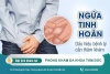 Triệu chứng ngứa tinh hoàn là bệnh lý gì? Phương pháp điều trị nhanh chóng