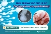 Tinh trùng vón cục là gì? Có nguy hiểm không?