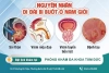 Đi đái bị buốt - Nguyên nhân và cách hỗ trợ điều trị hiệu quả