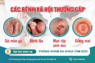 Những bệnh nào lây nhiễm qua đường tình dục
