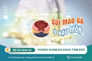 Sùi mào gà ở hậu môn có những biểu hiện gây chú ý gì