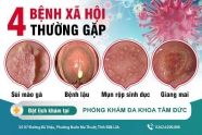 Khám và điều trị bệnh xã hội chất lượng tại Phòng Khám Đa Khoa Tâm Đức