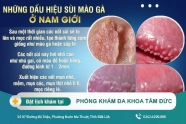 Dấu hiệu bị sùi mào gà ở nam mà bạn nên biết