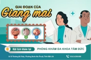 Bệnh giang mai và các giai đoạn của bệnh mà bạn cần biết