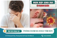 Ở nam giới xuất hiện mụn rộp sinh dục. Nguyên nhân và dấu hiệu nhận biết