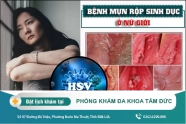 Bệnh mụn rộp sinh dục ở nữ giới là gì? Bệnh có nguy hiểm không?