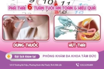 Thời Điểm Đình Chỉ Thai