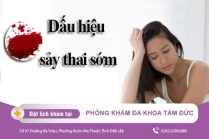 Sảy thai