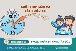 Giải pháp chống xuất tinh sớm – Giúp quan hệ tình dục được lâu