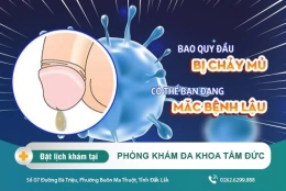 Chảy mủ bao quy đầu: Nguyên nhân - Phương pháp điều trị - Địa chỉ thăm khám giỏi
