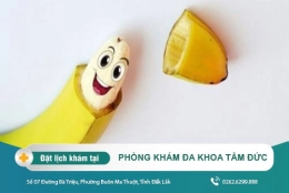 Tại sao phải cắt bao quy đầu và lợi ích khi cắt bao quy đầu