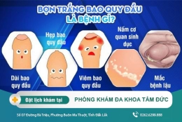 Bợn trắng bao quy đầu và những điều cần biết