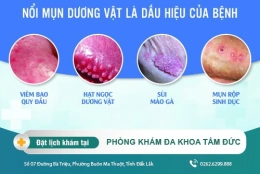 Mọc mụn ở dương vật là do đâu? Có cách điều trị tình trạng này hiệu quả không?
