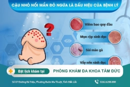 Cậu nhỏ bị nổi mẩn đỏ ngứa có nguy hiểm không? Điều trị như thế nào cho hiệu quả?