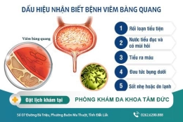 Nhận biết dấu hiệu bệnh viêm bàng quang ở nam giới và cách điều trị