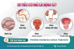 Đi tiểu có mủ là bệnh gì và cách điều trị