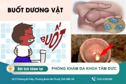 Cách trị dương vật bị buốt tại Đắk Lắk - Dương vật bị buốt là bệnh gì?