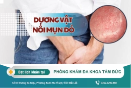 Nguyên nhân khiến đầu dương vật nổi mụn đỏ không ngứa? Đâu là cách điều trị hiệu quả?