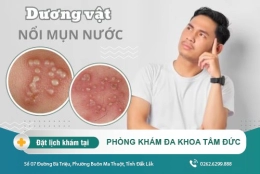 Đầu dương vật nổi mụn nước là bị gì? Nguyên nhân và cách điều trị ra sao?