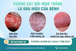 Dương vật nổi mụn trắng và những điều quan trọng phái nam cần biết