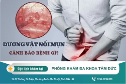 Bị nổi mụn ở cậu nhỏ phải làm sao? Bật mí phương pháp điều trị hiệu quả