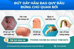 Chi phí nối dây hãm bao quy đầu là bao nhiêu?