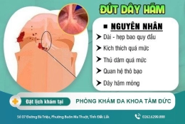 Bị đứt dây hãm bao quy đầu có sao không và cách xử lý như thế nào?