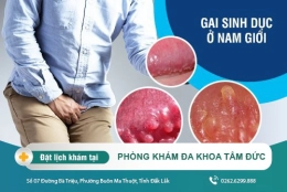 Gai sinh dục nam có nguy hiểm không? Cách chữa an toàn, hiệu quả