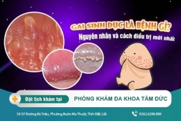 Nguyên nhân gai sinh dục ở nam giới và các tác hại khi mắc phải