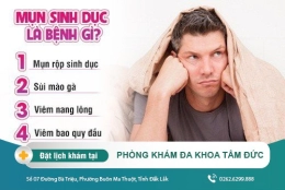 Không nên chủ quan với bệnh mụn sinh dục