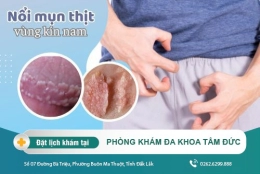 Bị nổi mụn thịt ở vùng kín nam có nguy hiểm không? Cách chữa hiệu quả