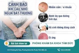 Ngứa dương vật nguyên nhân là gì? Khắc phục ngứa dương vật bằng cách nào