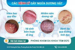 Ngứa dương vật ở nam giới là bệnh gì? Mách bạn phương pháp điều trị hiệu quả hiện nay