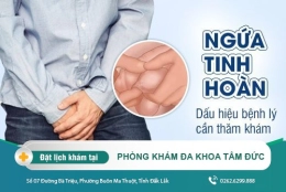Triệu chứng ngứa tinh hoàn là bệnh lý gì? Phương pháp điều trị nhanh chóng