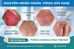 Nguyên nhân gây ngứa đau rát vùng kín nam - cách trị ngứa vùng kín nam hiệu quả