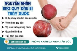 Trầy xước bao quy đầu - nguy cơ mắc bệnh lý nếu lơ là