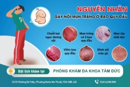 Nổi mụn trắng ở bao quy đầu có nguy hiểm không? Cách điều trị ra sao?