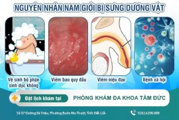 Cách trị sưng dương vật tại Đắk Lắk - Tác hại khi bị sưng dương vật