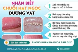 Dương vật nổi hạt ngọc có dấu hiệu nhận biết như thế nào? Điều trị bằng phương pháp nào?