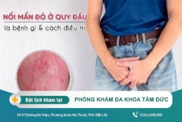 Nổi mẫn đỏ bao quy đầu là bệnh gì?