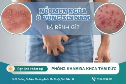 Nổi mụn ngứa ở vùng kín nam: Nguyên nhân và cách điều trị