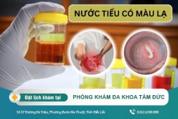 Nước tiểu có màu lạ báo hiệu bệnh gì? Nước tiểu có màu gì là tốt?