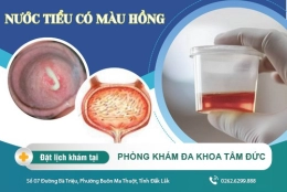 Đi tiểu ra nước tiểu hồng là dấu hiệu bệnh gì? Tác hại và cách điều trị như thế nào?