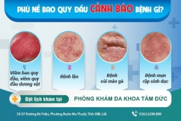 Phù nề bao quy đầu: Dấu hiệu của bệnh gì? Cách điều trị hiệu quả hiện nay