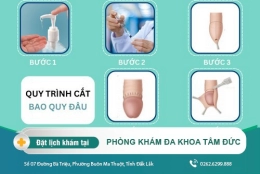 Không cắt bao quy đầu có sao không? Lợi ích khi cắt bao quy đầu