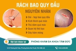 Tình trạng rách bao quy đầu ở nam giới - Nguyên nhân và cách khắc phục